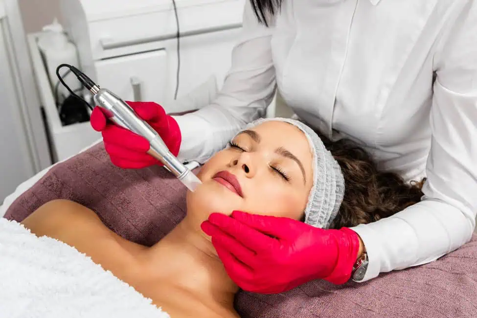 microneedling by Rae Aesthetics and Wellness LLC in Jacksonville, FL