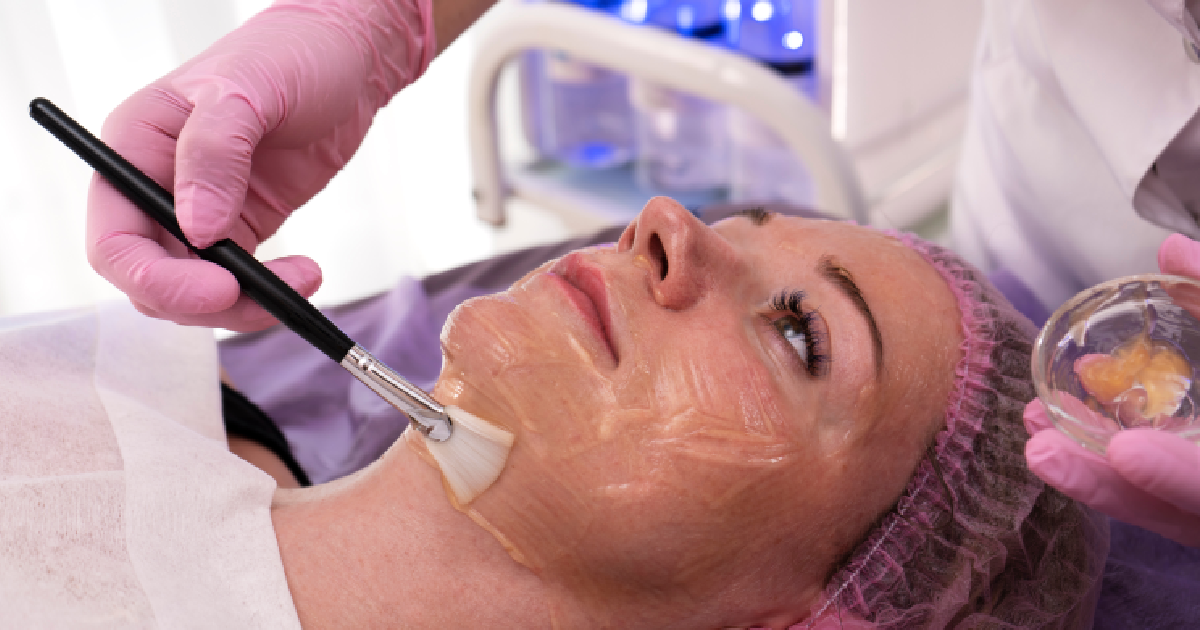 Women receiving a chemical peel treatment in Jacksonville, FL