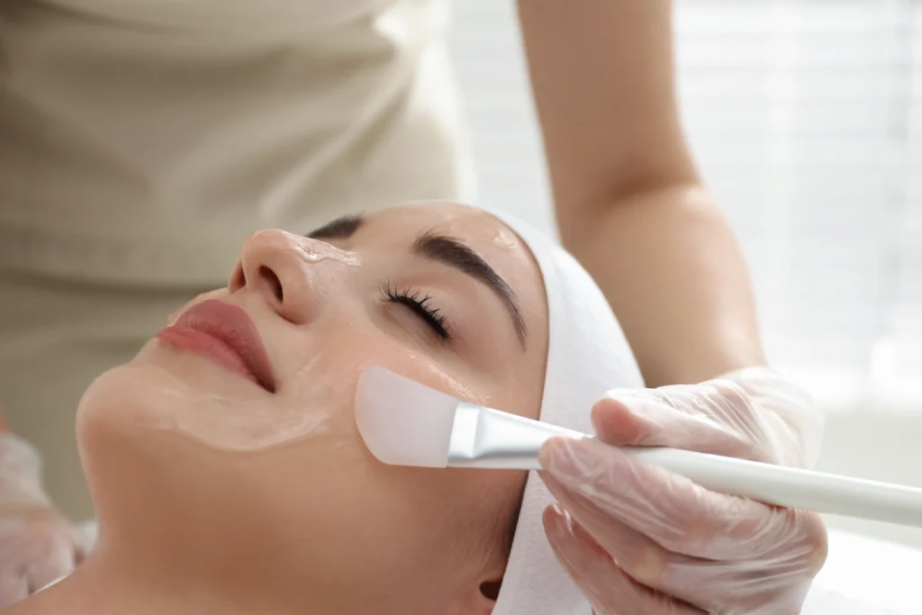 Chemical Peel Treatment for Radiant Skin In Jacksonville